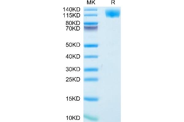 Oncostatin M Receptor Protein (OSMR) (AA 28-740) (His tag)