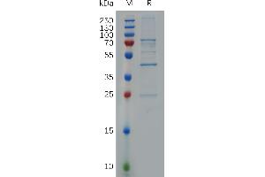 Human B10 Protein, N-S Tag on SDS-PAGE under reducing condition. (HSD17B10 Protein (AA 2-261) (S tag))