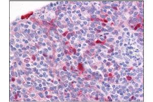 Human Tonsil: Formalin-Fixed, Paraffin-Embedded (FFPE) (Girdin anticorps  (C-Term))