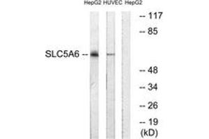 Western Blotting (WB) image for anti-Solute Carrier Family 5 (Iodide Transporter), Member 6 (SLC5A6) (AA 551-600) antibody (ABIN2890649) (SLC5A6 anticorps  (AA 551-600))