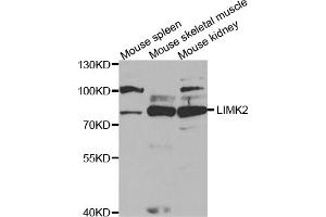 Western blot analysis of extracts of various cell lines, using LIMK2 antibody (ABIN5973137) at 1/1000 dilution. (LIMK2 anticorps)