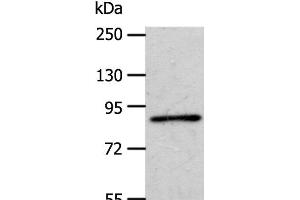 Western Blot analysis of A172 cell using APPL1 Polyclonal Antibody at dilution of 1:600 (APPL1 anticorps)