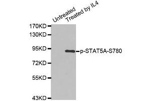 Western blot analysis of extracts from K562 cells using Phospho-STAT5A-S780 antibody (ABIN2987413). (STAT5A anticorps  (pSer780))
