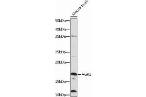 Western blot analysis of extracts of Mouse testis, using  Rabbit mAb (ABIN6134271, ABIN6138179, ABIN6138182 and ABIN7101399) at 1:1000 dilution. (AGR2 anticorps)