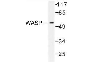 Image no. 1 for anti-Wiskott-Aldrich Syndrome (Eczema-thrombocytopenia) (WAS) antibody (ABIN272092) (WASP anticorps)