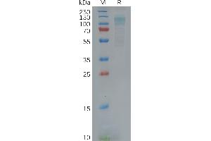 Human AD Protein, His Tag on SDS-PAGE under reducing condition. (F4/80 Protein (AA 21-599) (His tag))