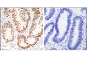 Immunohistochemistry (IHC) image for anti-Mitogen-Activated Protein Kinase 14 (MAPK14) (pTyr182) antibody (ABIN2888496) (MAPK14 anticorps  (pTyr182))