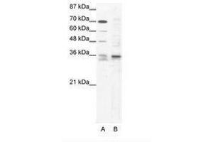 Image no. 1 for anti-SRY (Sex Determining Region Y)-Box 12 (SOX12) (C-Term) antibody (ABIN202223) (SOX12 anticorps  (C-Term))