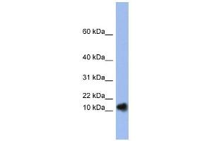 RNASE1 antibody used at 1 ug/ml to detect target protein. (RNASE1 anticorps)