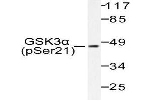 Western blot (WB) analysis of p-GSK3alpha antibody in extracts from ovary cancer. (GSK3 alpha anticorps  (pSer21))