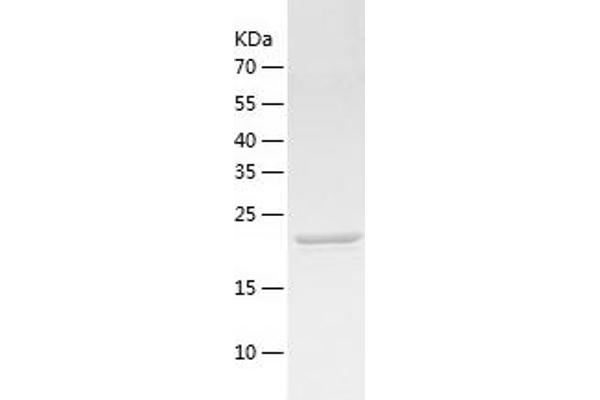 UCHL1 Protein (AA 1-223) (His tag)