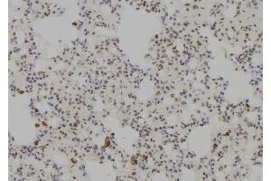 ABIN6277782 at 1/100 staining Rat lung tissue by IHC-P. (Nemo-Like Kinase anticorps  (N-Term))