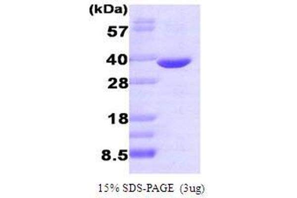 AKR1B1 Protein (AA 1-316)