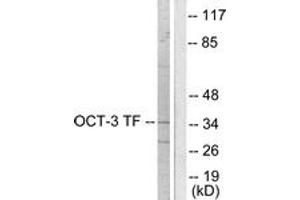 Western Blotting (WB) image for anti-POU Class 5 Homeobox 1 (POU5F1) (AA 191-240) antibody (ABIN2889240) (OCT4 anticorps  (AA 191-240))