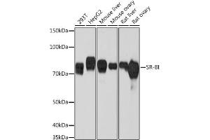 Western blot analysis of extracts of various cell lines, using SR-BI Rabbit mAb (ABIN7270156) at 1:1000 dilution. (SCARB1 anticorps)