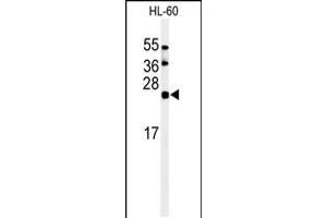 Western blot analysis of in HL-60 cell line lysates (35ug/lane) (ISG15 anticorps  (C-Term))