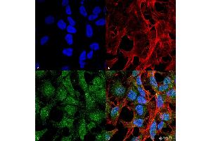 Immunocytochemistry/Immunofluorescence analysis using Rabbit Anti-UVRAG Polyclonal Antibody . (UVRAG anticorps  (Biotin))