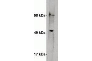 Image no. 1 for anti-serine Palmitoyltransferase, Long Chain Base Subunit 1 (SPTLC1) antibody (ABIN201813) (SPTLC1 anticorps)