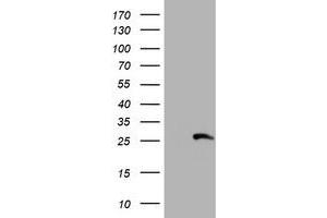 HEK293T cells were transfected with the pCMV6-ENTRY control (Left lane) or pCMV6-ENTRY RFXANK (Right lane) cDNA for 48 hrs and lysed. (RFXANK anticorps)