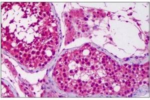 Immunohistochemistry (IHC) image for anti-Ubiquitin-Like Modifier Activating Enzyme 6 (UBA6) (AA 962-1052) antibody (ABIN955420) (UBA6 anticorps  (AA 962-1052))