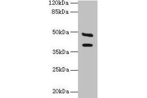 Western blot All lanes: CA12 antibody at 6 μg/mL + Mouse kidney tissue Secondary Goat polyclonal to rabbit IgG at 1/10000 dilution Predicted band size: 40, 39 kDa Observed band size: 40, 48 kDa (CA12 anticorps  (AA 25-301))