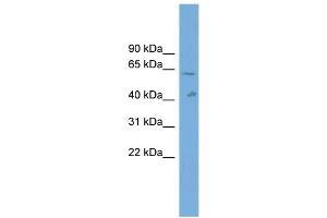 WB Suggested Anti-SLC22A10 Antibody Titration: 0. (SLC22A10 anticorps  (Middle Region))