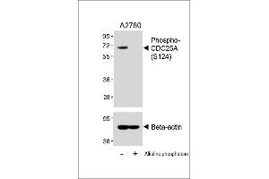 Western blot analysis of lysates from  cell line, untreated or treated with Alkaline phosphatase, 1h, using 459085101 A (upper) or Beta-actin (lower). (CDC25A anticorps  (pSer124))