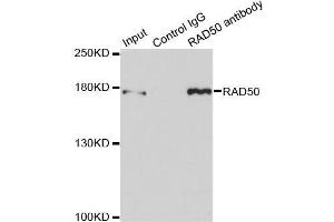Immunoprecipitation analysis of 150 μg extracts of MCF7 cells using 3 μg RAD50 antibody (ABIN5971576). (RAD50 anticorps)