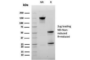 SDS-PAGE Analysis Purified CD20 Mouse Monoclonal Antibody (MS4A1/3410). (CD20 anticorps  (AA 213-297))