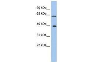 Image no. 1 for anti-DEAD (Asp-Glu-Ala-Asp) Box Polypeptide 3, X-Linked (DDX3X) (N-Term) antibody (ABIN6742671) (DDX3X anticorps  (N-Term))