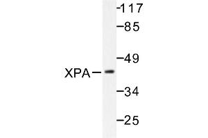 Image no. 1 for anti-Xeroderma Pigmentosum, Complementation Group A (XPA) antibody (ABIN271978) (XPA anticorps)