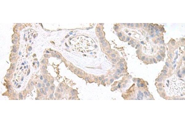 Double-stranded RNA-binding protein Staufen homolog 2 (STAU2) anticorps