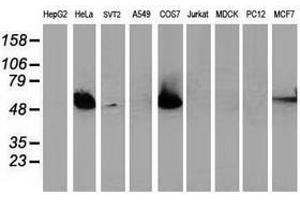 Image no. 2 for anti-Tumor Protein P53 (TP53) antibody (ABIN1499975) (p53 anticorps)