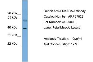 WB Suggested Anti-PRKACA  Antibody Titration: 0. (PRKACA anticorps  (N-Term))