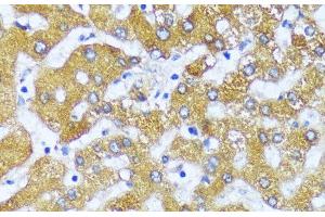 Immunohistochemistry of paraffin-embedded Human liver using ACOX2 Polyclonal Antibody at dilution of 1:100 (40x lens). (Acox2 anticorps)