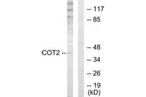 Western blot analysis of extracts from HuvEc cells, using COT2 Antibody. (Grr1p anticorps  (AA 1-50))