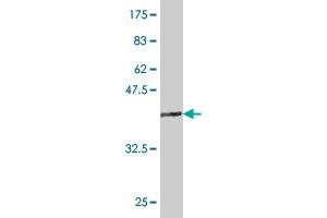 Western Blot detection against Immunogen (36. (TLX3 anticorps  (AA 192-291))