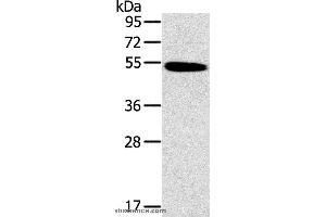 Western blot analysis of Human normal colon tissue, using HRH1 Polyclonal Antibody at dilution of 1:200 (HRH1 anticorps)