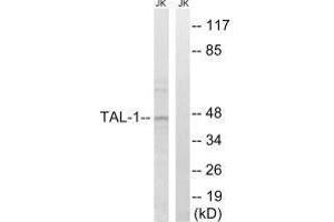 Western blot analysis of extracts from Jurkat cells, treated with PMA (125 ng/mL, 30 mins), using TAL-1 (Ab-122) antibody. (TAL1 anticorps  (Ser122))