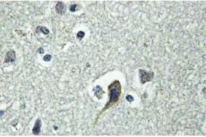 Image no. 2 for anti-Parathyroid Hormone 1 Receptor (PTH1R) antibody (ABIN317698) (PTH1R anticorps)