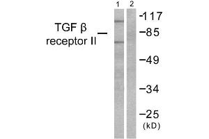 Western Blotting (WB) image for anti-Transforming Growth Factor, beta Receptor II (70/80kDa) (TGFBR2) (Internal Region) antibody (ABIN1848792) (TGFBR2 anticorps  (Internal Region))