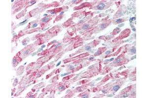 Immunohistochemistry (IHC) image for anti-Amyloid beta (Abeta) (N-Term) antibody (ABIN95037)