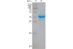 Human ST-Nanodisc, Flag Tag on SDS-PAGE (STEAP1 Protéine)