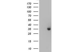 HEK293T cells were transfected with the pCMV6-ENTRY control (Left lane) or pCMV6-ENTRY ERCC1 (Right lane) cDNA for 48 hrs and lysed. (ERCC1 anticorps)