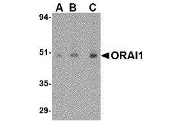 ORAI1 anticorps  (C-Term)