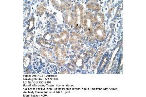 Rabbit Anti-AGER Antibody  Paraffin Embedded Tissue: Human Kidney Cellular Data: Epithelial cells of renal tubule Antibody Concentration: 4. (RAGE anticorps  (C-Term))