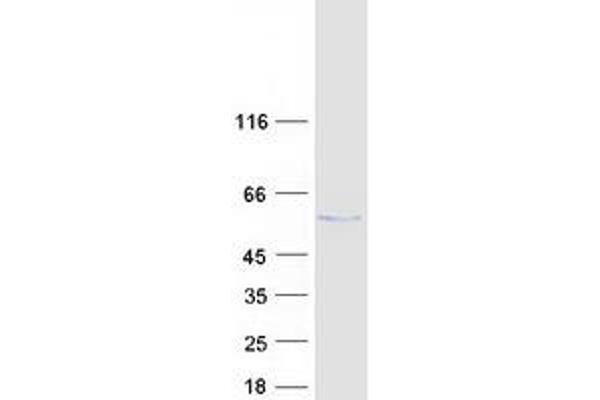 CTU2 Protein (Transcript Variant 1) (Myc-DYKDDDDK Tag)