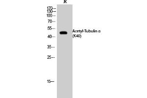 Western Blot analysis of JK cells using Acetyl-Tubulin α (K40) Polyclonal Antibody. (alpha Tubulin anticorps  (acLys40))