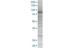 EPS8 transfected lysate. (EPS8 293T Cell Transient Overexpression Lysate(Denatured))