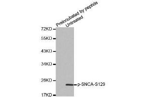 Western blot analysis of extracts from mouse brain tissue, using Phospho-SNCA-S129 antibody (ABIN2988301). (SNCA anticorps  (pSer129))